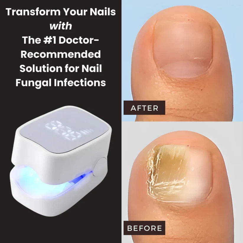 Nail Fungus Laser Device